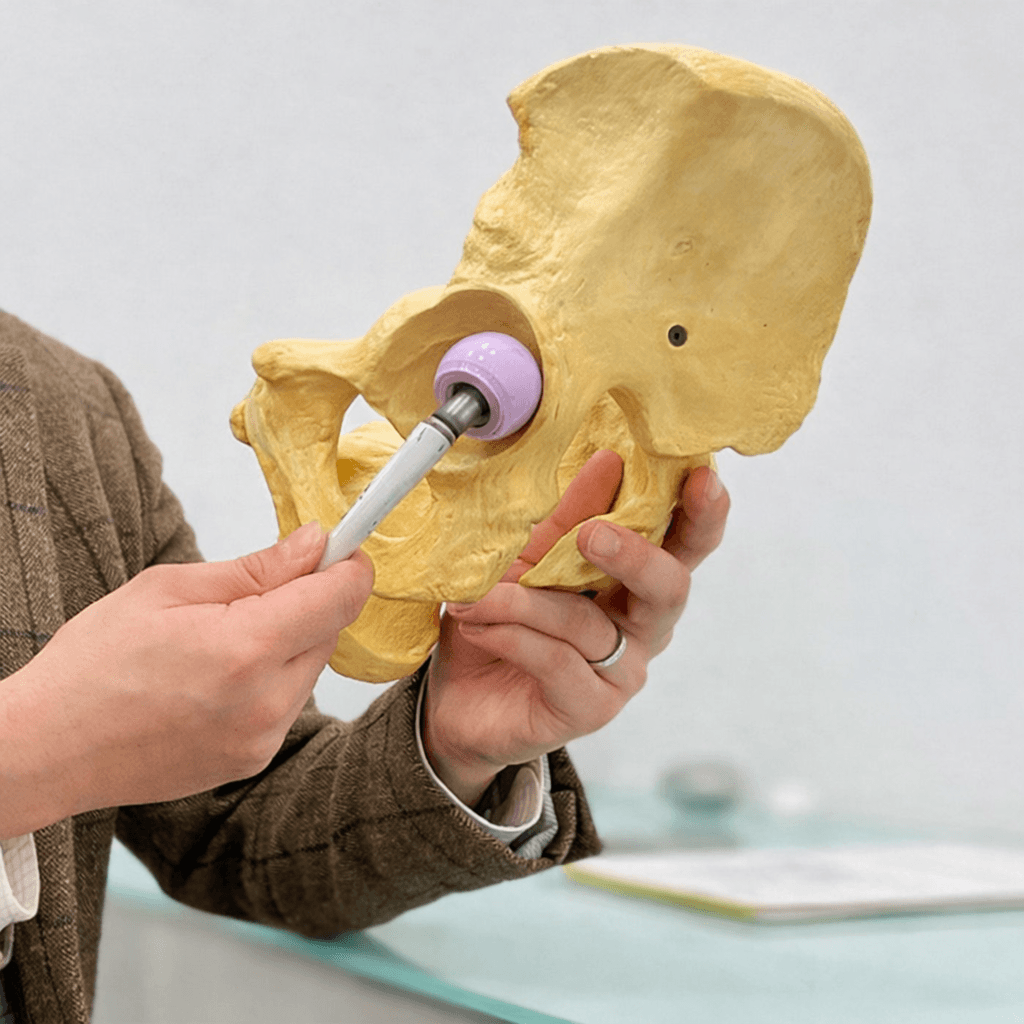 Hip fracture and arthroplasty demonstration on a pelvis model