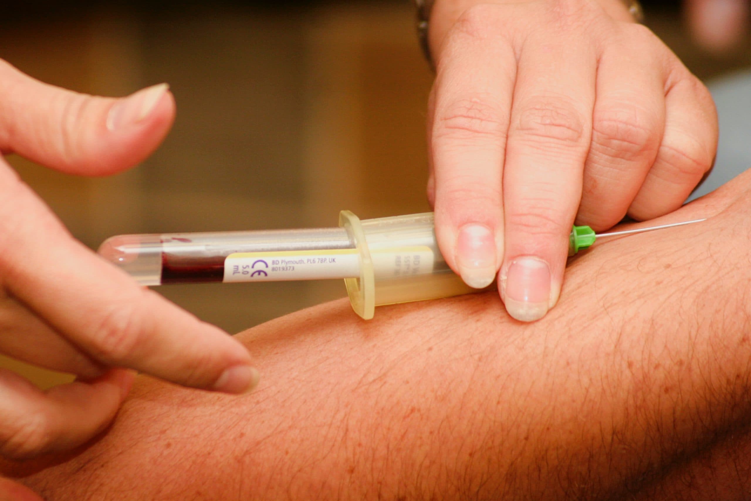 Joint injections and orthobiologics