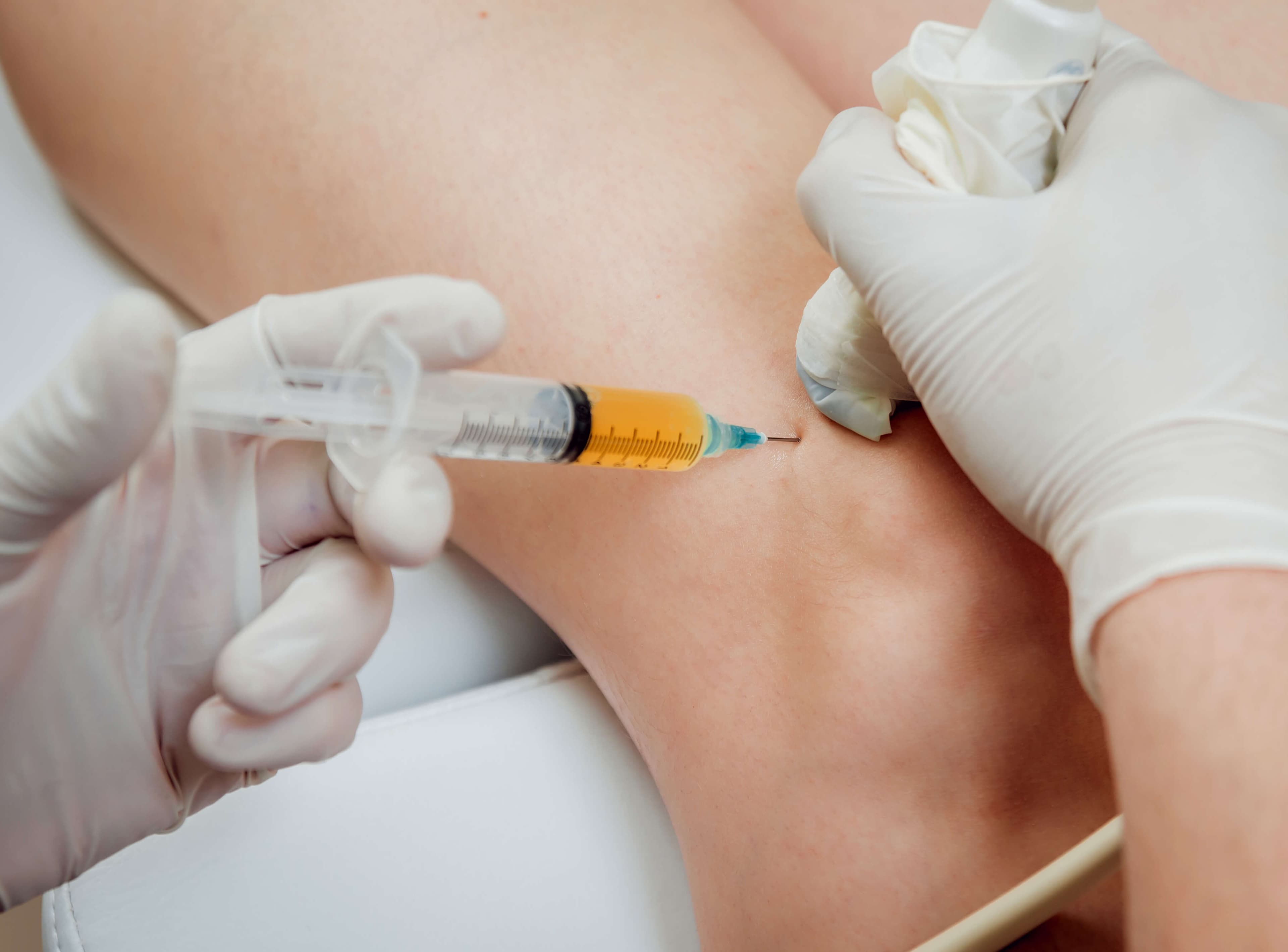 Joint Injections
